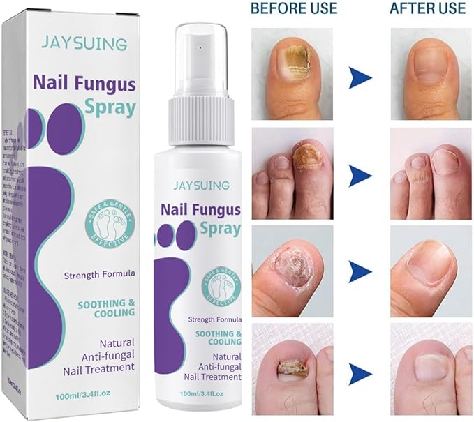 Gentle Nail Fungus Remover