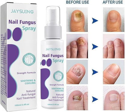 Gentle Nail Fungus Remover